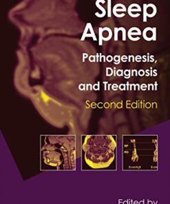 Sleep Apnea Pathogenesis, Diagnosis and Treatment 2nd Edition by Allan I. Pack