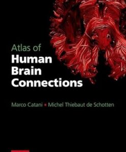 Atlas of Human Brain Connections