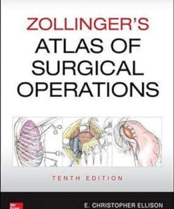 Zollinger's Atlas of Surgical Operations, 10th Edition