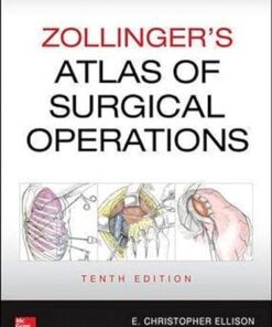 Zollinger's Atlas of Surgical Operations 10th Edition