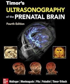 Timor's Ultrasonography of the Prenatal Brain 4th Edition